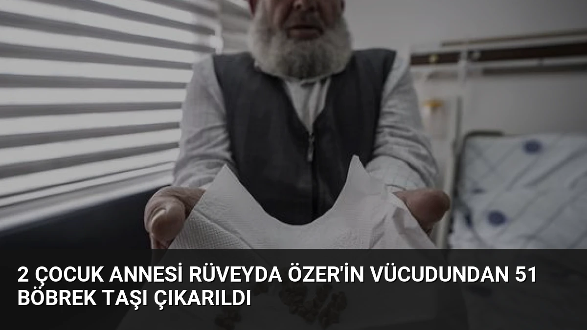 2 Çocuk Annesi Rüveyda Özer’in Vücudundan 51 Böbrek Taşı Çıkarıldı