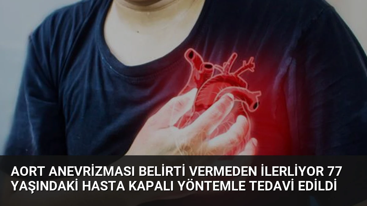 Aort Anevrizması Belirti Vermeden İlerliyor 77 Yaşındaki Hasta Kapalı Yöntemle Tedavi Edildi